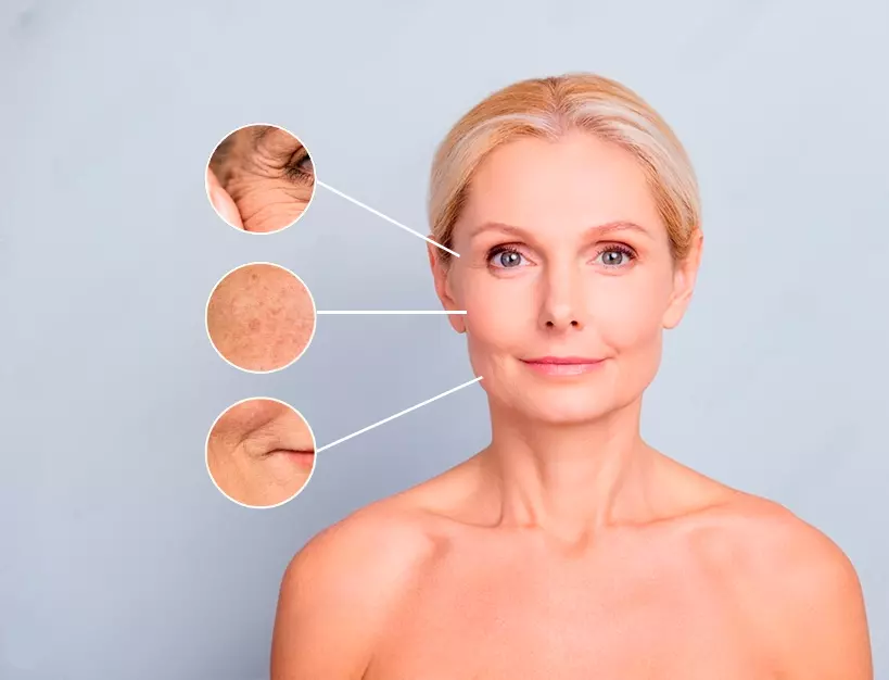 HARMONIZAÇÃO FACIAL NATURAL