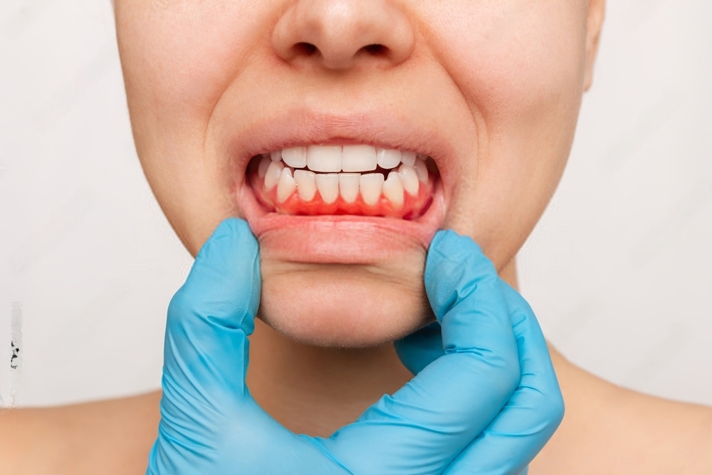 PERIODONTIA